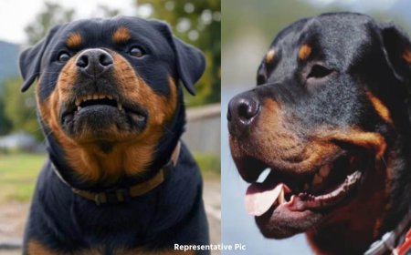 महिला को रॉटविलर कुत्तों ने काटा, सिर, हाथ और पैर पर लगे 200 टांके, हाथ की दो हड्डियां टूटीं