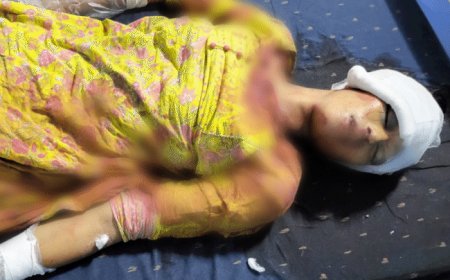 पूर्व कांग्रेस विधायक की नौकरानी ने खुद को गोली मारी:चित्रकूट में नीलांशु के घर में लाइसेंसी पिस्टल से किया फायर; 2 महीने बाद थी शादी