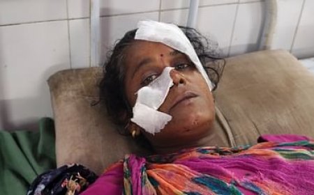 कमरे में सो रही महिला पर गुलदार ने किया हमला, दरवाजा तोड़कर बाहर खींचा, पति ने बचाई जान